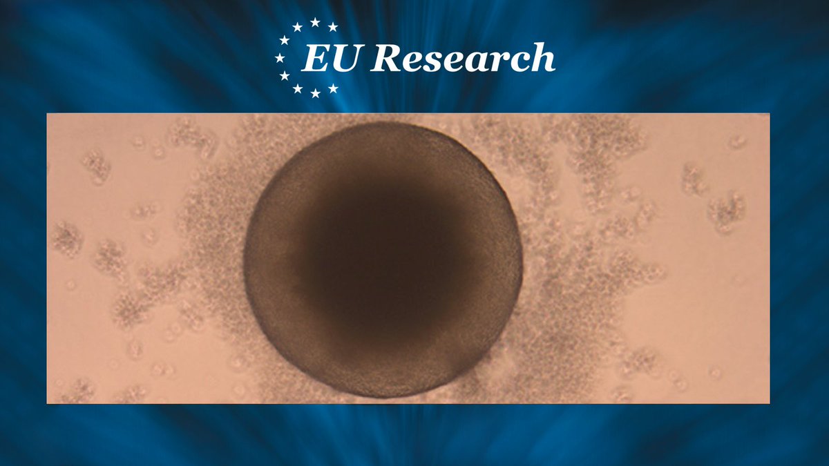 EU_RESEARCH's tweet photo. While most primate species have some degree of folding in the brain there are some exceptions, now Dr Michael Heide and his colleagues in the Primazinc project aim to shed new light on the underlying reasons why.
https://t.co/2zR6CGZ6Cx
#Research #BrainDevelopment #Evolution https://t.co/ohMvcO0f4y