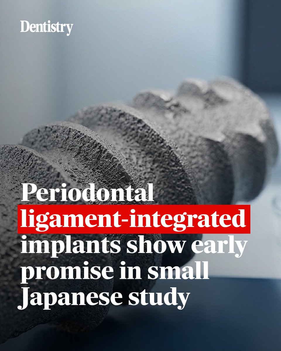Dentistry's tweet photo. 🦷A small Japanese study reports encouraging early results for periodontal ligament-integrated dental implants, which connect to the jaw through ligament tissue instead of conventional osseointegration alone👇

https://t.co/qWbqDK2r05 https://t.co/unsEu15OnE