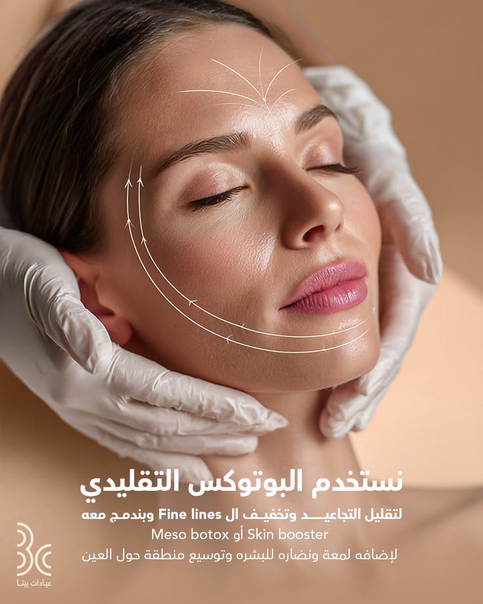 betaclinics's tweet photo. علاج للتجاعيد والـ Fine Lines… مع Glow طبيعي في نفس الوقت.
البوتوكس المدمج بيقدم لك النتيجتين معًا…جاهزة للتجربة؟

 احجزي الآن
 920003109
  0506925808
.
.
#عيادات_بيتا
#المدينة_المنورة https://t.co/ylfkuertnu