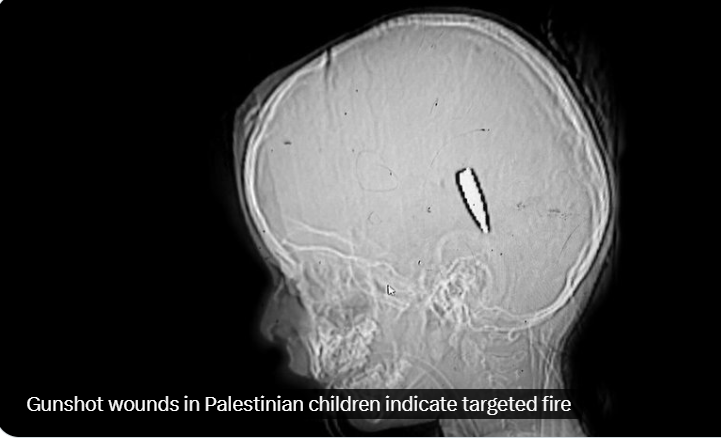 BarryAndrewsMEP's tweet photo. 🌟💔 Winner of the European Press Prize 2026 - the Dutch newspaper @volkskrant piece on how the @IDF deliberately shoots children in the head https://t.co/t3B4bB6Spu