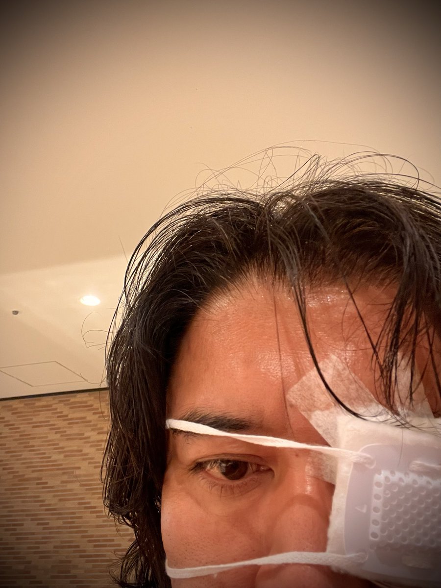 TaroKishimoto's tweet photo. すげぇ見られる…＠梅田。まぁ、何があったの？的なムードはあるのかも。いくら朝の手術だったとは言え手術当日に夜遅まで仕事2件入れてたのはバカだったのかも知れない。同じ手術の他の人は全員入院だったみたいだしなー。 https://t.co/BjJl0kQUns