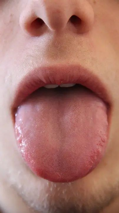 SabioSentido's tweet photo. Un neurólogo afirma:

"Saca la lengua durante 40 segundos: esto elimina el cortisol más rápido que cualquier pastilla o ejercicio de respiración."

La Big Pharma está en pánico: 🧵 https://t.co/IyiPyXXzVH