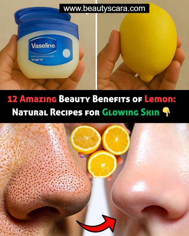 NattyNdamukunda's tweet photo. Benefits of lemon 🍋 https://t.co/ULfmFzzHDc