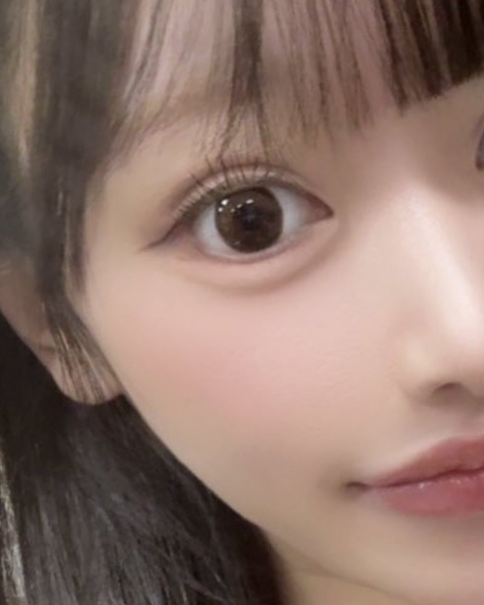 jjrn22_'s tweet photo. まだ術後5日目だけど額挙上よすぎる😭笑
目の開き、二重幅、目頭の形が変わって神になった✌️ https://t.co/mdOwBtUIpc