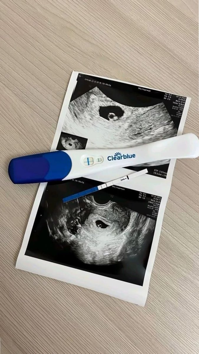 miggimage's tweet photo. cw / mpreg 

what should mg supposed to do after discovering he was pregnant by his neighbor, a man ten years younger than him?

he thought it would be nothing more than a one night stand with yh, the kind and handsome boy next door, a college student who works part-time at https://t.co/yu4GOVLUPJ