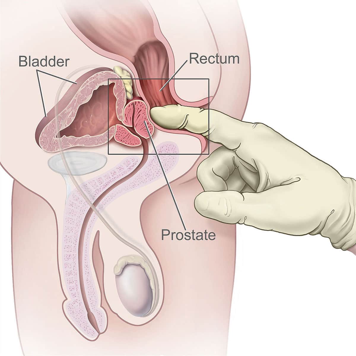 illegal9911's tweet photo. @CarrotCakeKiwi @813Jitss @versacemistress @servinaunt10s @laflameclipping yea the foreskin known to have a bunch of feeling in 😭😭 a bunch of religions push circymcision but its mainly for health, but anyways heres a graph where your prostate is https://t.co/gMOGVvYoPW