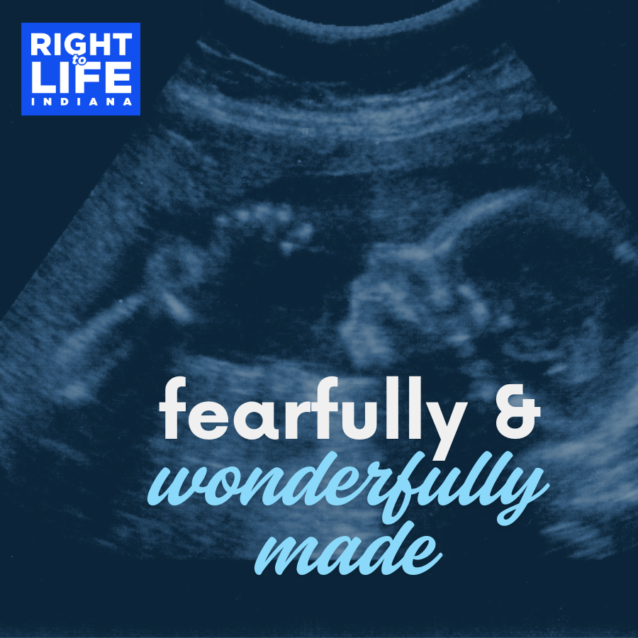 irtl's tweet photo. "I praise you because I am fearfully and wonderfully made." - Psalm 139:14 https://t.co/T2yRFhDISi