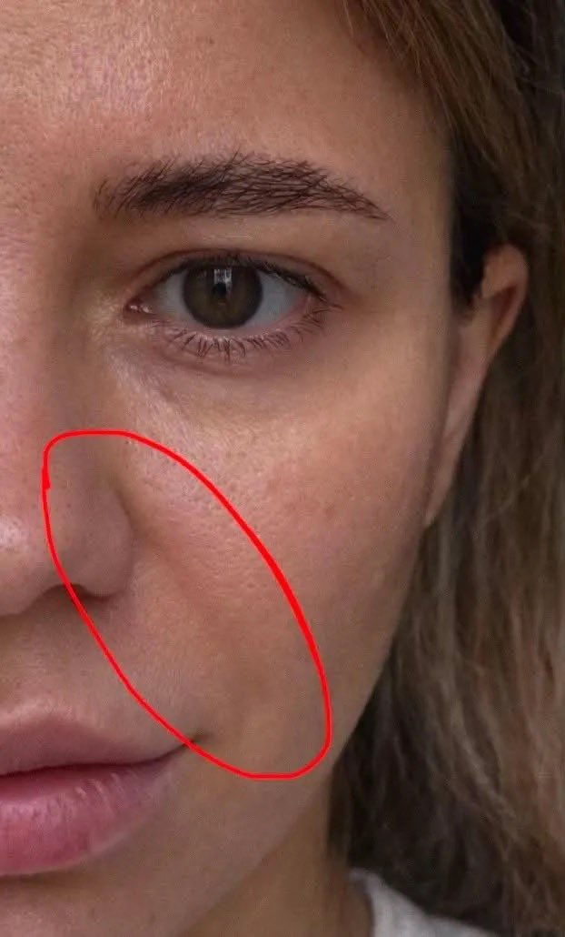 manbchild's tweet photo. meninas… USEM RETINOL, sério, fez muita diferença na minha vida.

mudou minha pele de um jeito absurdo 😭
linhas suavizaram, textura melhorou
e esse glow aqui??? absurdo!

passada que ninguém fala disso! https://t.co/B2PxcEDaa6