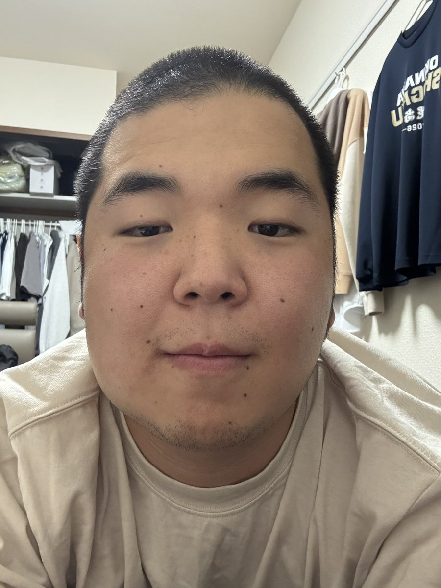taimyon3636's tweet photo. 親知らず抜くとこうなります🥺
左頬腫れてる(–_–“) https://t.co/0vUANVR6l6