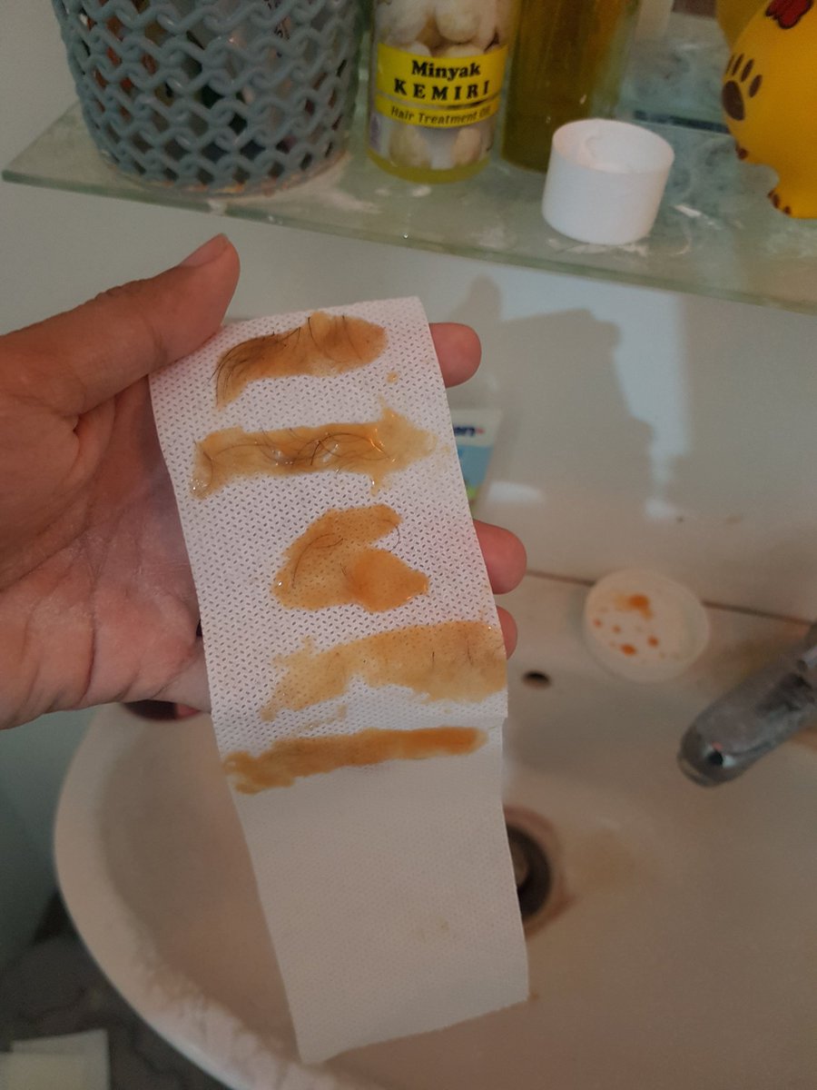 Zae_n69's tweet photo. First time nyobain waxing kumis yg ga seberapa ini wkwk https://t.co/v7CPUbz38T