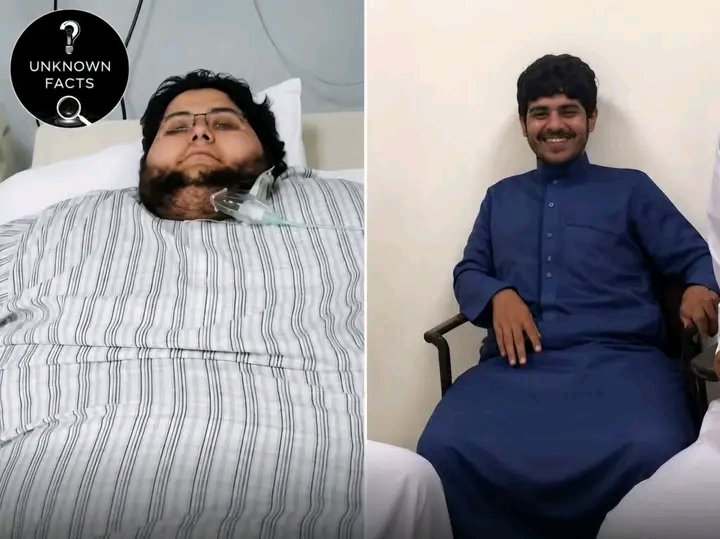 JeanEkila's tweet photo. MIRACLE. En 2013, Khalid bin Mohsen Shaari, 22 ans, pesait 608 kg et était alité depuis 3 ans.
Pris en charge en Arabie saoudite sur ordre du roi Abdallah, il a reçu une équipe médicale, chirurgie, régime strict et #rééducation, #perdant 544 kg et retrouvant la marche en 2016. https://t.co/Jqdqqw5W2K