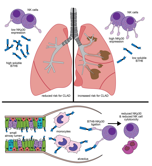 AJRCMB's tweet photo. Circulating B7H6 is associated with reduced NKp30 receptor expression and improved lung transplant recipient survival

https://t.co/0KjegZ8PeU

@DocCalabrese 
@atscommunity https://t.co/uGf4o9XWxX