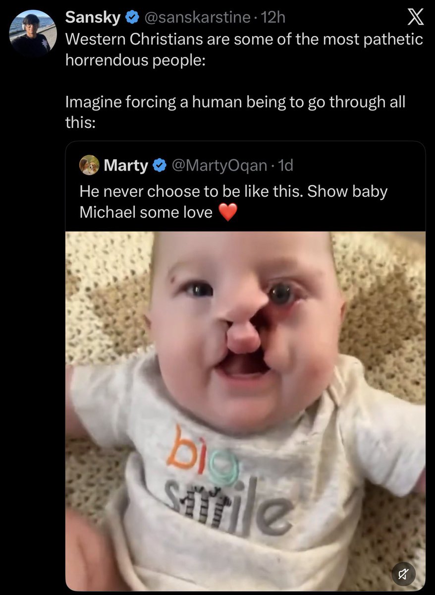 Braeden tweet media