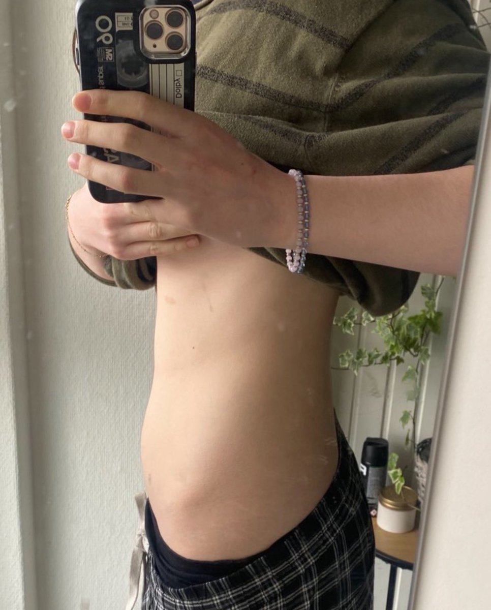 IgotLynched's tweet photo. Old bc omg I was literally bmi 21 here fuckkkk I need this back https://t.co/xXBY6vxB66
