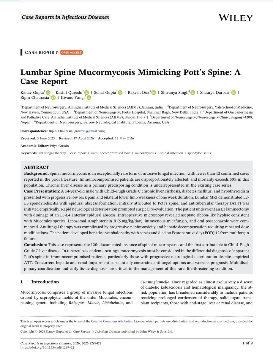drkivancyangi's tweet photo. I am pleased to share that our case report, “Lumbar Spine Mucormycosis Mimicking Pott’s Spine: A Case Report,” has been published in Case Reports in Infectious Diseases.

This report describes an exceptionally rare case of spinal mucormycosis presenting as presumed Pott’s disease in an immunocompromised patient. The case highlights the diagnostic challenges of fungal spinal infections, the importance of early tissue diagnosis, and the need to maintain a broad differential diagnosis.

📖 Read the full article: https://t.co/uiDtVFeAar