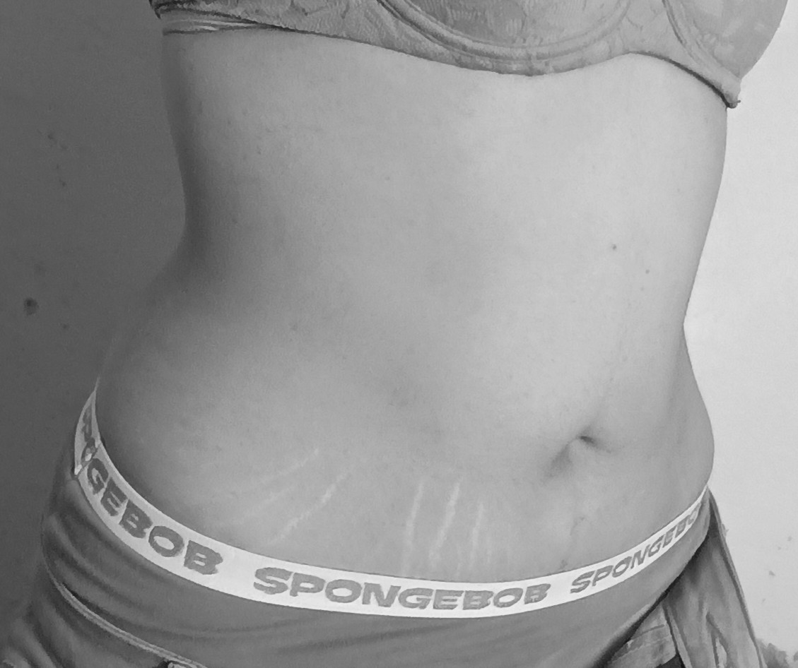 Saramej08's tweet photo. Progress from working out✨
#WorkoutProgress
#BodyTransformation https://t.co/tjz9VPCMAb