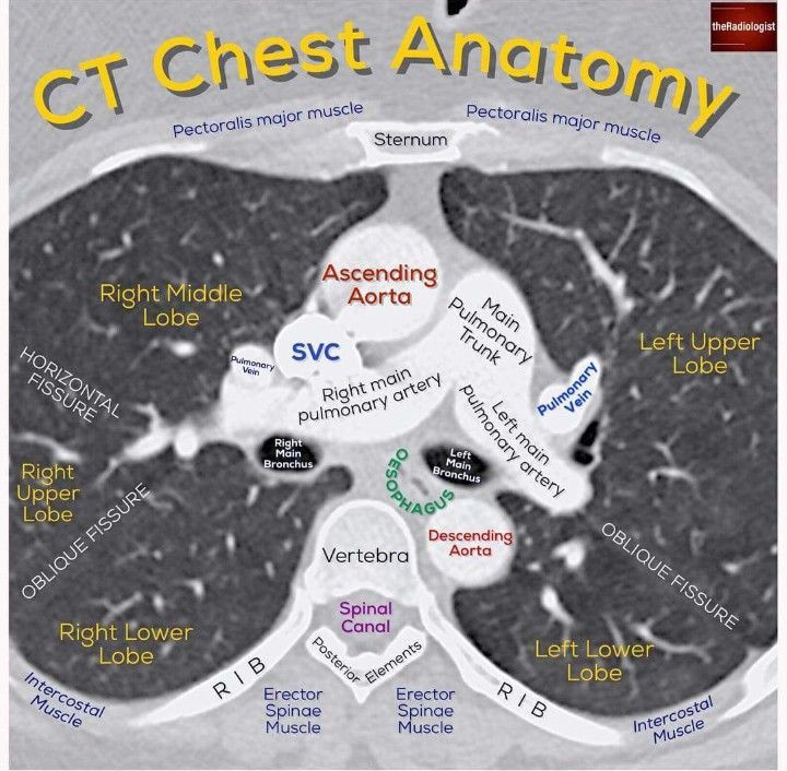 TrackYourHeart's tweet photo. CT Chest Anatomy
Image courtesy of: @radiologistpage https://t.co/HOBXmASN4h