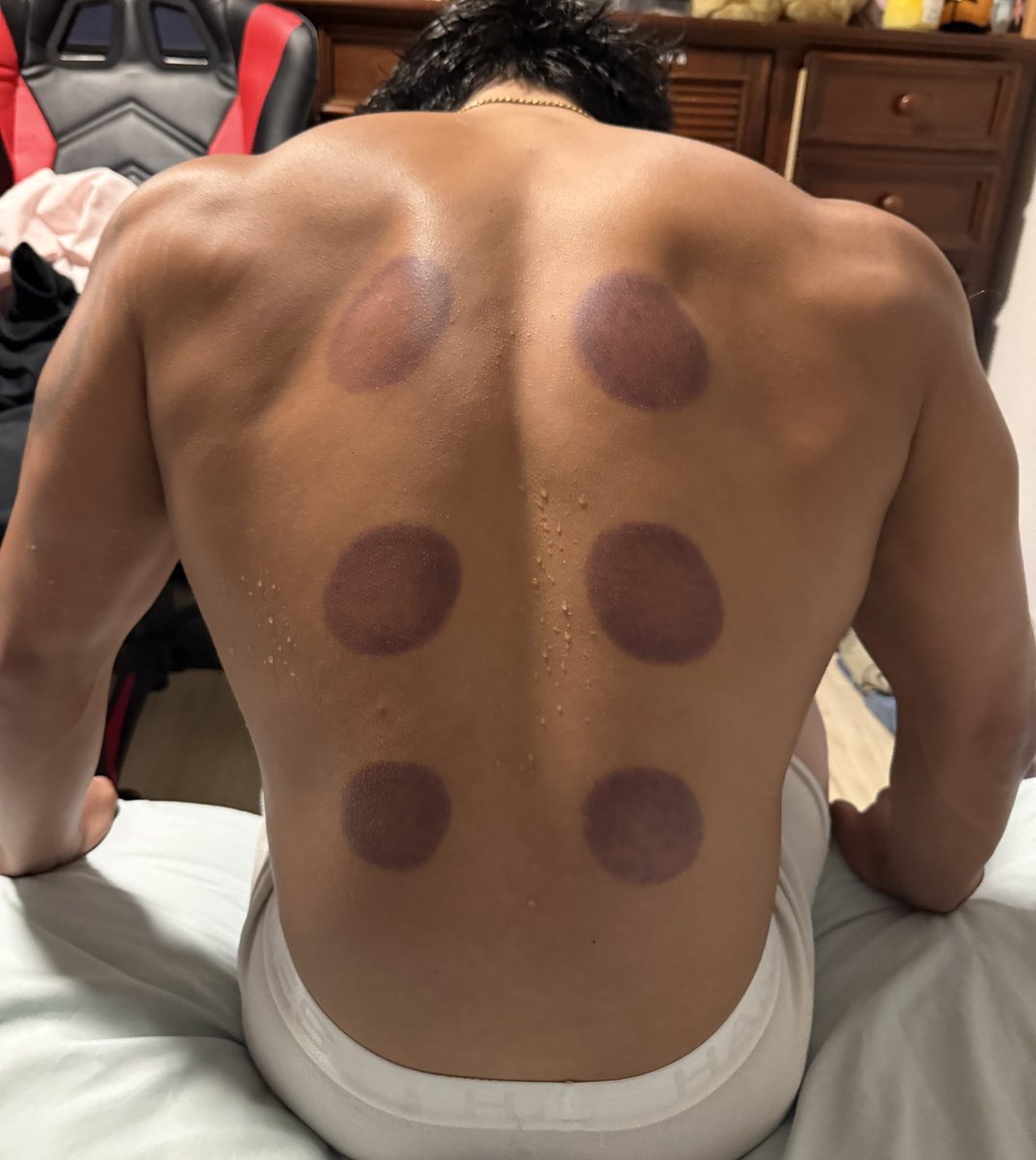 pinoboyyy's tweet photo. who wants to come grab my back? https://t.co/ilibdKndE8