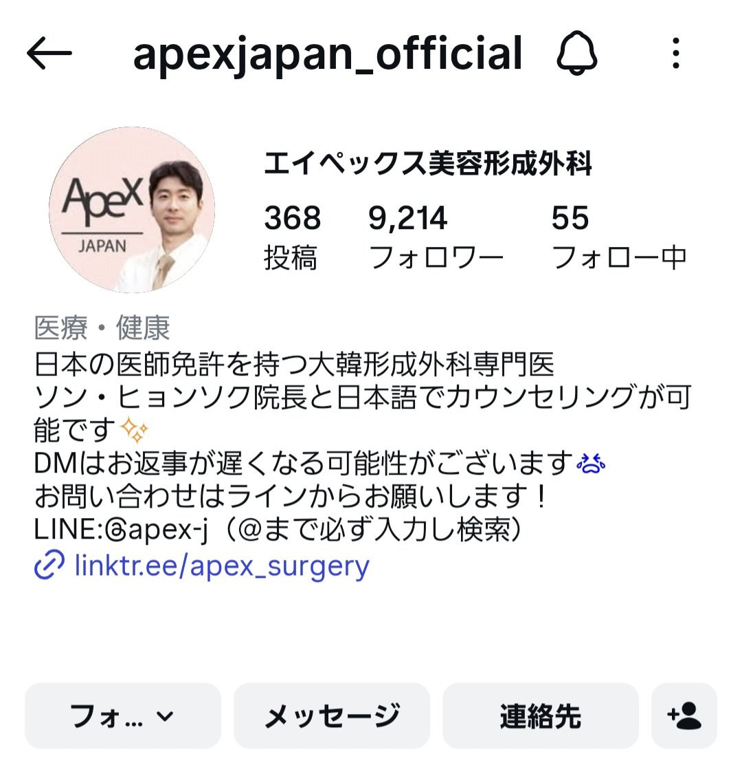 nyunnyun05's tweet photo. 一条響ちゃんが二重切開した病院と先生公開してくれた👨‍⚕️✨
- Apex🇰🇷エイペックス美容形成外科
- ソン・ヒョンソク院長

二重切開(ハイブリッド法)
ちょいつり目の希望の目元&amp;たるみが改善されるらしくて最高すぎんか何より術後３日目とは思えない腫れのなさ経過が良すぎる
#整形垢さんと繋がりたい https://t.co/a9PL7q4KXi