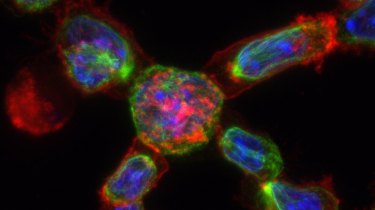 CRUK_CI's tweet photo. How do our T cells become efficient cancer killers? 

New research from the de la Roche Group has uncovered a previously unknown element of the Hedgehog signalling pathway that enhances T cells' ability to destroy infected and cancerous cells. 

Read here: https://t.co/2keOuXvwTi https://t.co/TP1rHNRbQa