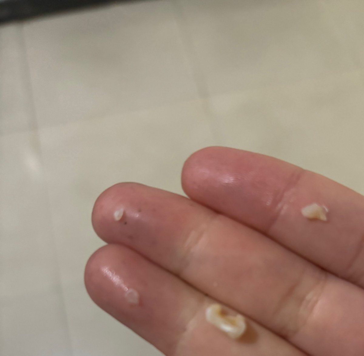 pirnmmm's tweet photo. 안녕 독감이 거의 다 나앗는데 방금 전에 쓰러졋고(?) 앞니 두 개가 날아갔어요(?)....... https://t.co/1qPcFMwRbX