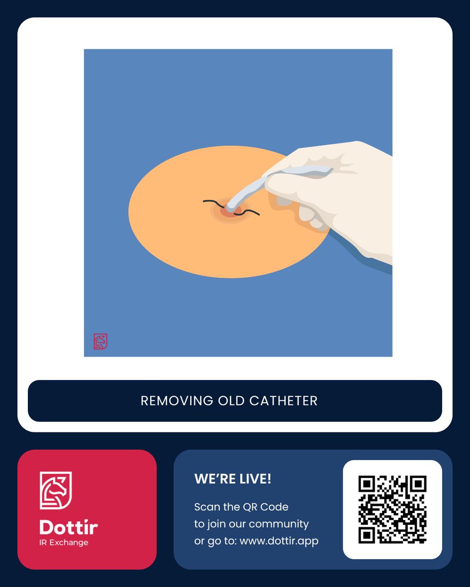 dottir_uk's tweet photo. rom the patient’s signs and symptoms to the final procedure, this is the step-by-step Nephrostomy Exchange process.

Follow us across all social media for expert insights, and register at https://t.co/B6VvQA2RZm to take your IR knowledge and skills to the next level. 🚀 https://t.co/flQCgRSbPL
