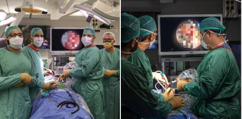 ACOM_es's tweet photo. 🇮🇱 Hito de la medicina israelí: en el Hospital Ichilov (Tel Aviv) han extirpado un tumor de la base del cráneo sin abrirlo.
La técnica transorbitaria endoscópica se trata de un abordaje que ya gana terreno en centros líderes de todo el mundo para lesiones seleccionadas. La novedad radica en la vía de acceso: una diminuta incisión en el párpado superior y un abordaje endoscópico a través de la órbita. La paciente conservó la visión y se recuperó rápidamente.
Otra contribución de Israel al mundo que los antisemitas NO BOICOTEARÁN.