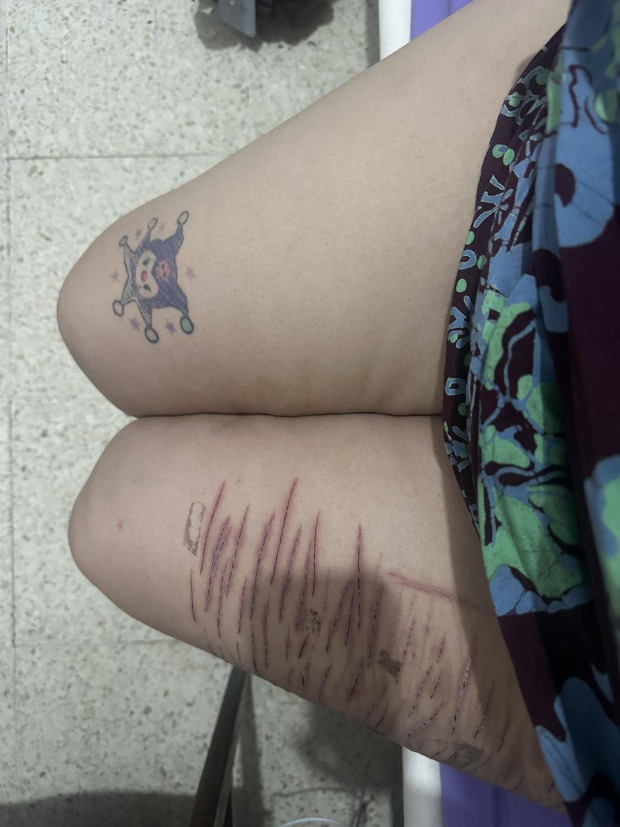 picnicaskets's tweet photo. -2kg the last couple days :’)
almost out of bmi 44 jail

#edrtwt #ricecaketwt #shedtwt all sfx makeup dont put me in locked jail pls twt https://t.co/HUh8lR5kyX