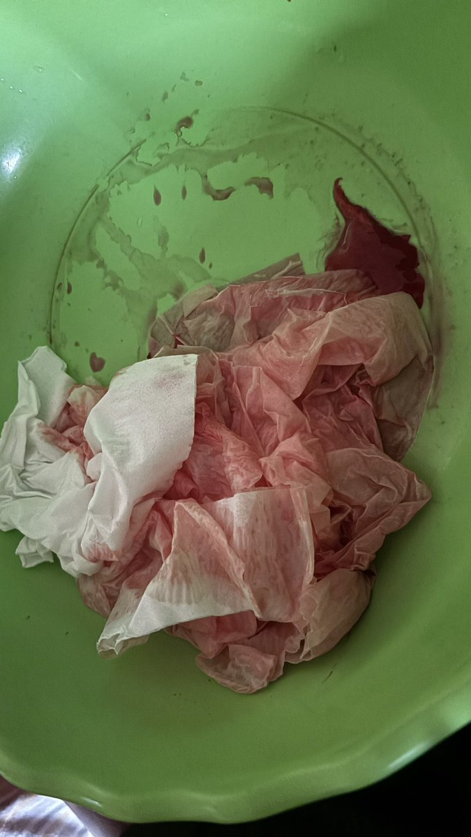 lelippo's tweet photo. Perjuangan meng-ASI-hi. Lumayan sering kejadian. Pernah beberapa kali yang sampe menggumpal2 juga. Tapi (tentu atas izinNya) aku hebat. Nyatanya hampir 16 bulan ini jadi full mom eping. MasyaAllah 🥹😭 https://t.co/jwpGlPTeXC
