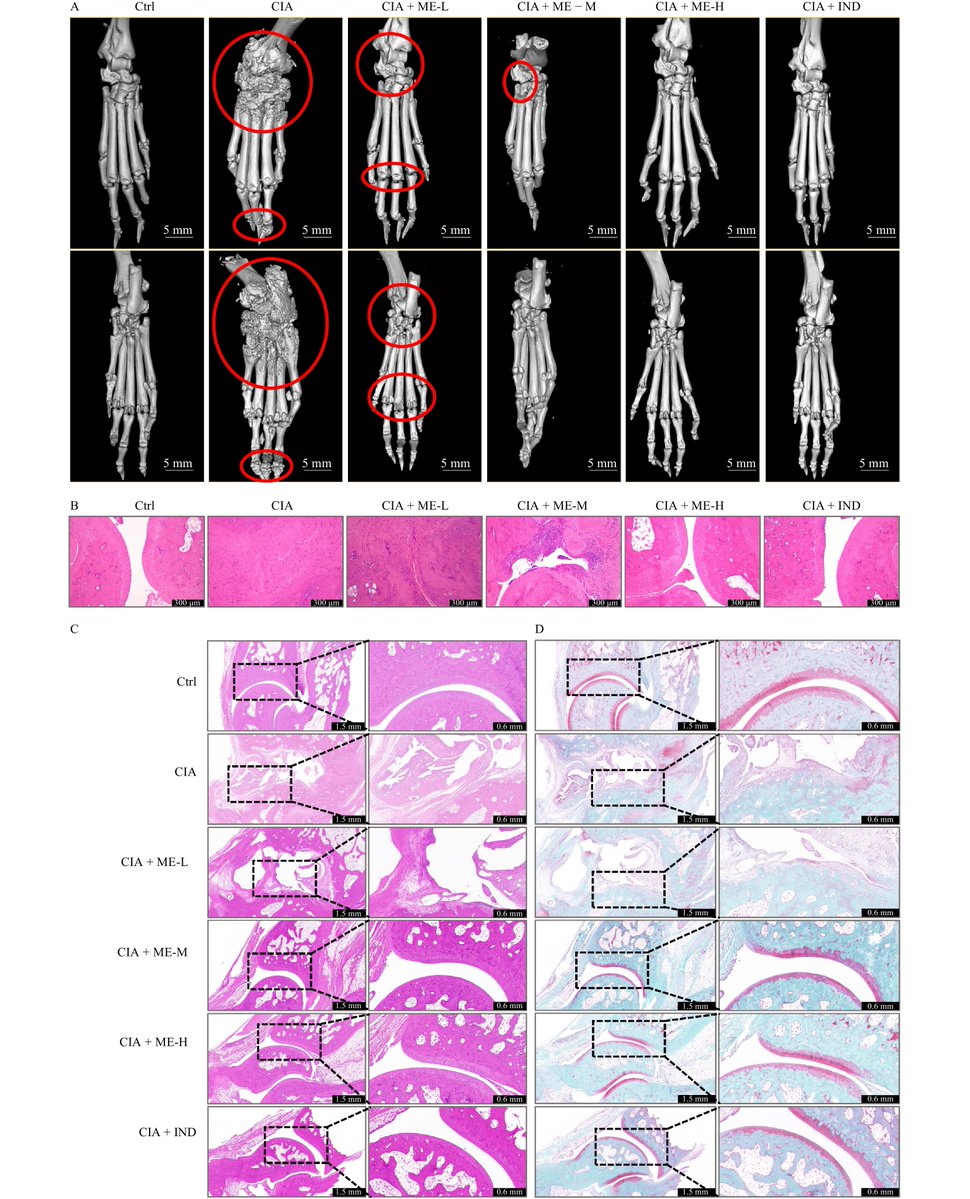 JournalCJNM's tweet photo. Investigate the anti-arthritic potential of Murraya exotica L. (ME) in this groundbreaking study! 🌿
Characterized via UPLC, ME extract—rich in meranzin hydrate and murrayone—demonstrates significant therapeutic benefits in collagen-induced arthritis (CIA) models. By inhibiting synovial hyperplasia, bone erosion, and oxidative stress, ME effectively modulates the NF-κB and AP-1 signaling pathways. Molecular docking and CETSA/DARTS assays confirm strong interactions between ME-derived compounds and NF-κB p65, preventing nuclear translocation and suppressing inflammatory responses.
These findings provide the first evidence for ME as a promising natural candidate for Rheumatoid Arthritis (RA) management, offering a multi-target approach to autoimmune joint destruction. 🔬🦴

#RheumatoidArthritis #MurrayaExotica #NaturalProducts #AutoimmuneDisease #Inflammation