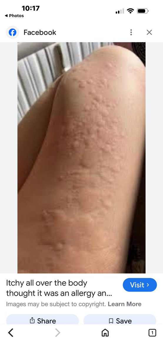 CubLord76's tweet photo. @Bella__Bahby After doing some research, I found the same exact picture with a lighter skinned leg and the same background. https://t.co/7o7uAJpTZp