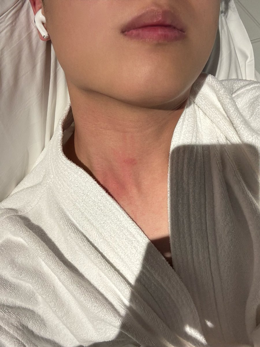 azezeze9's tweet photo. 什么时候能被老公种草莓而不是🦟 https://t.co/J8fXdxyVbC