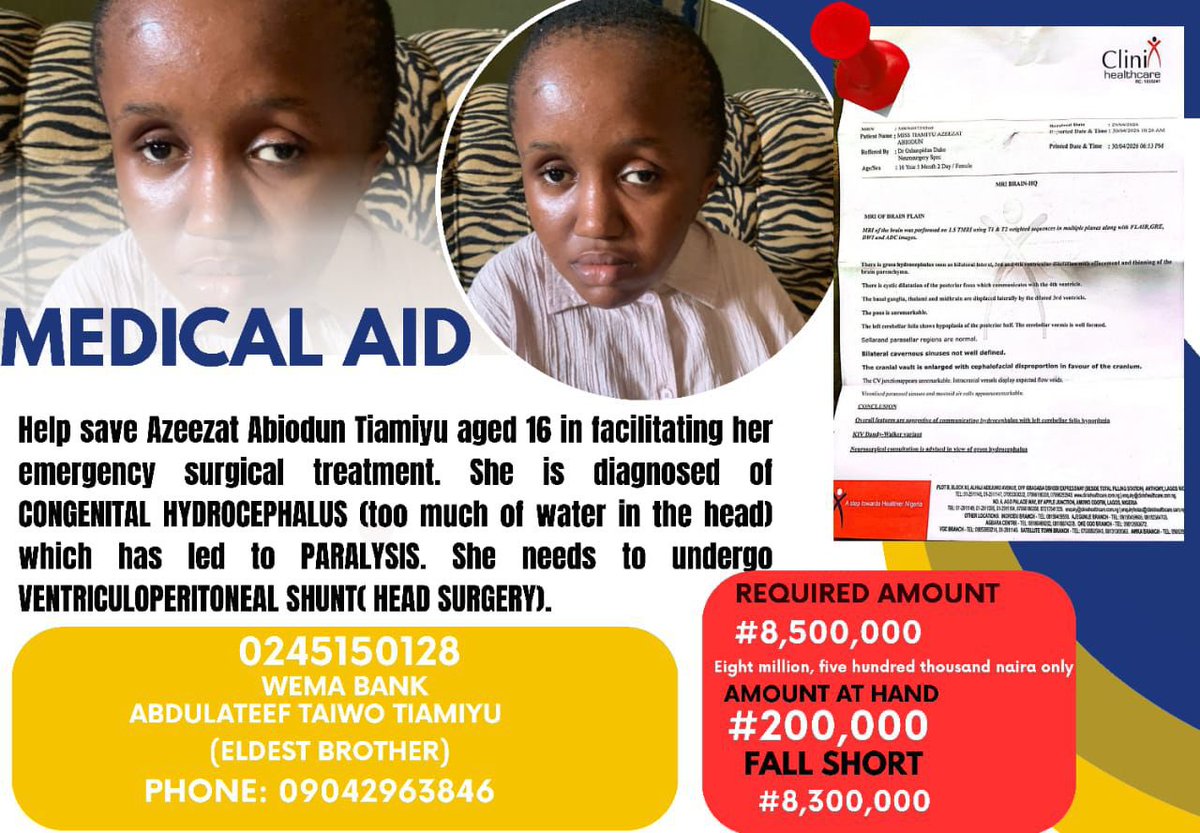 Halamine11's tweet photo. @peace_igho 

Help Save Azeezat's Life*
*Azeezat Abiodun Tiamiyu*, a brave little girl battling *Congenital Hydrocephalus*. She urgently needs financial aid for a critical head surgery that could change and save her life.
No amount is too small. Your support, prayers, and shares can save her