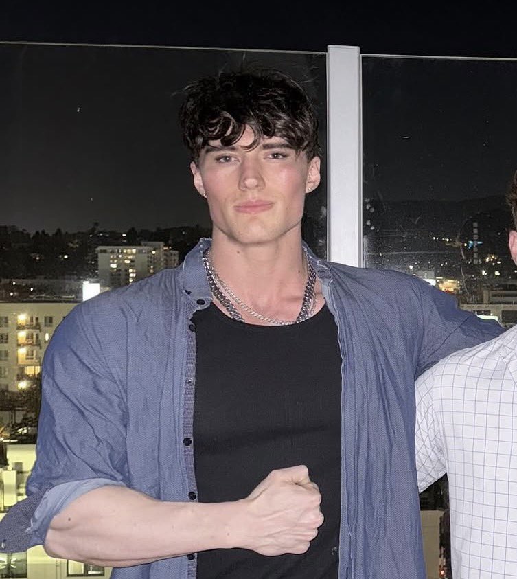 Clav0Updates's tweet photo. Clavicular’s friend Androgenic shows off how he looks after getting 4 cosmetic procedures 👀

▫️Rhinoplasty (February)
▫️Hair Transplant (February)
▫️Buccal Fat Removal (May)
▫️Jaw Liposuction (May) 

June 2025 vs June 2026 https://t.co/nqhRD9CdH4