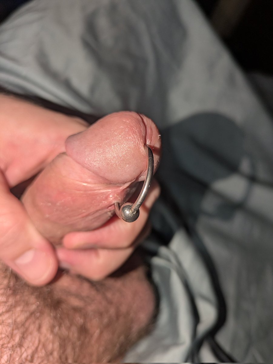 PupAleiptes's tweet photo. It's healing nicely.  Still can't top for a couple more weeks, though. https://t.co/1FtjMuIPW0