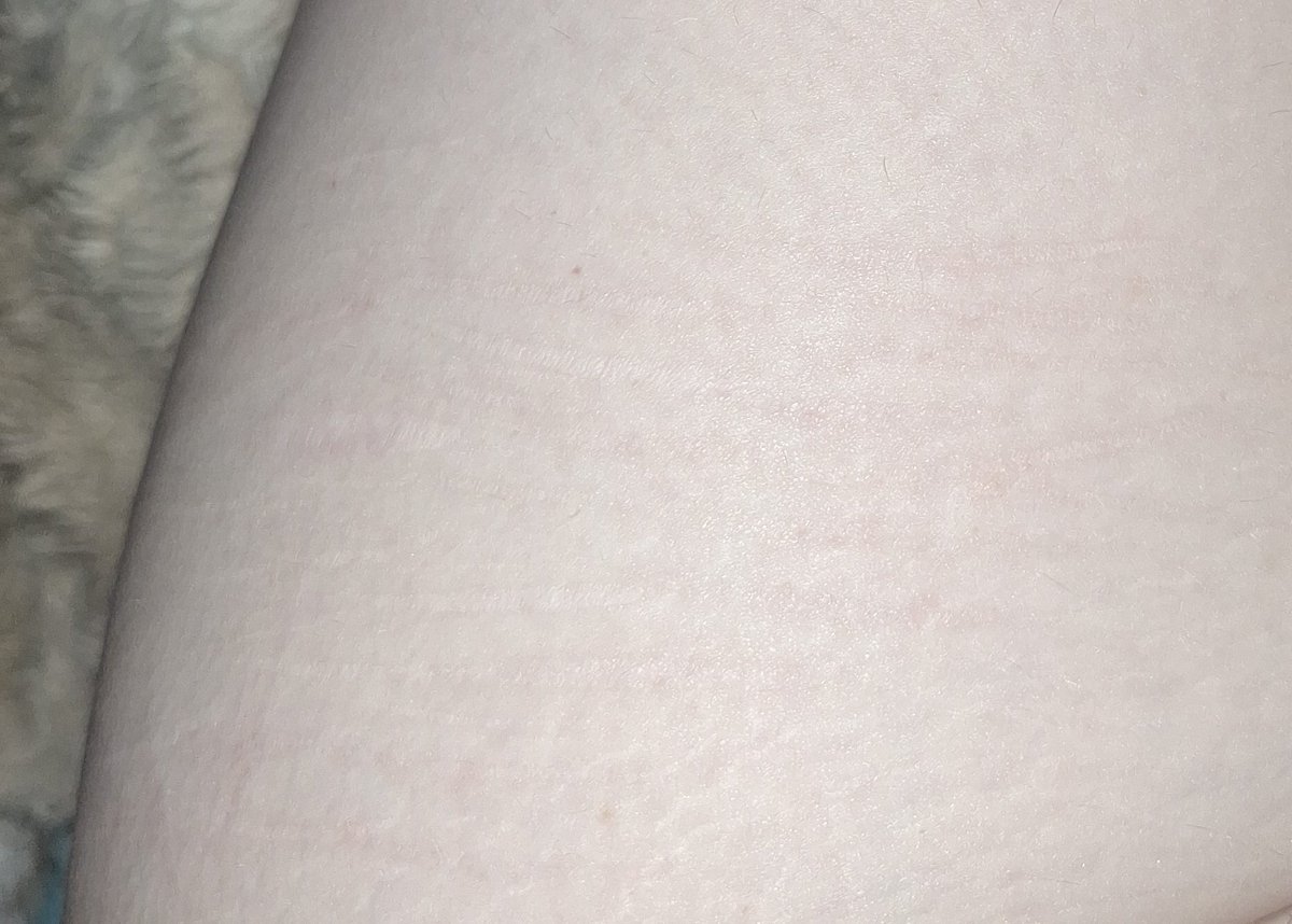 lesoomf's tweet photo. Okay I should just die. YOU CAN'T SEE THEM ANYMOEE https://t.co/DEoTmYHVco