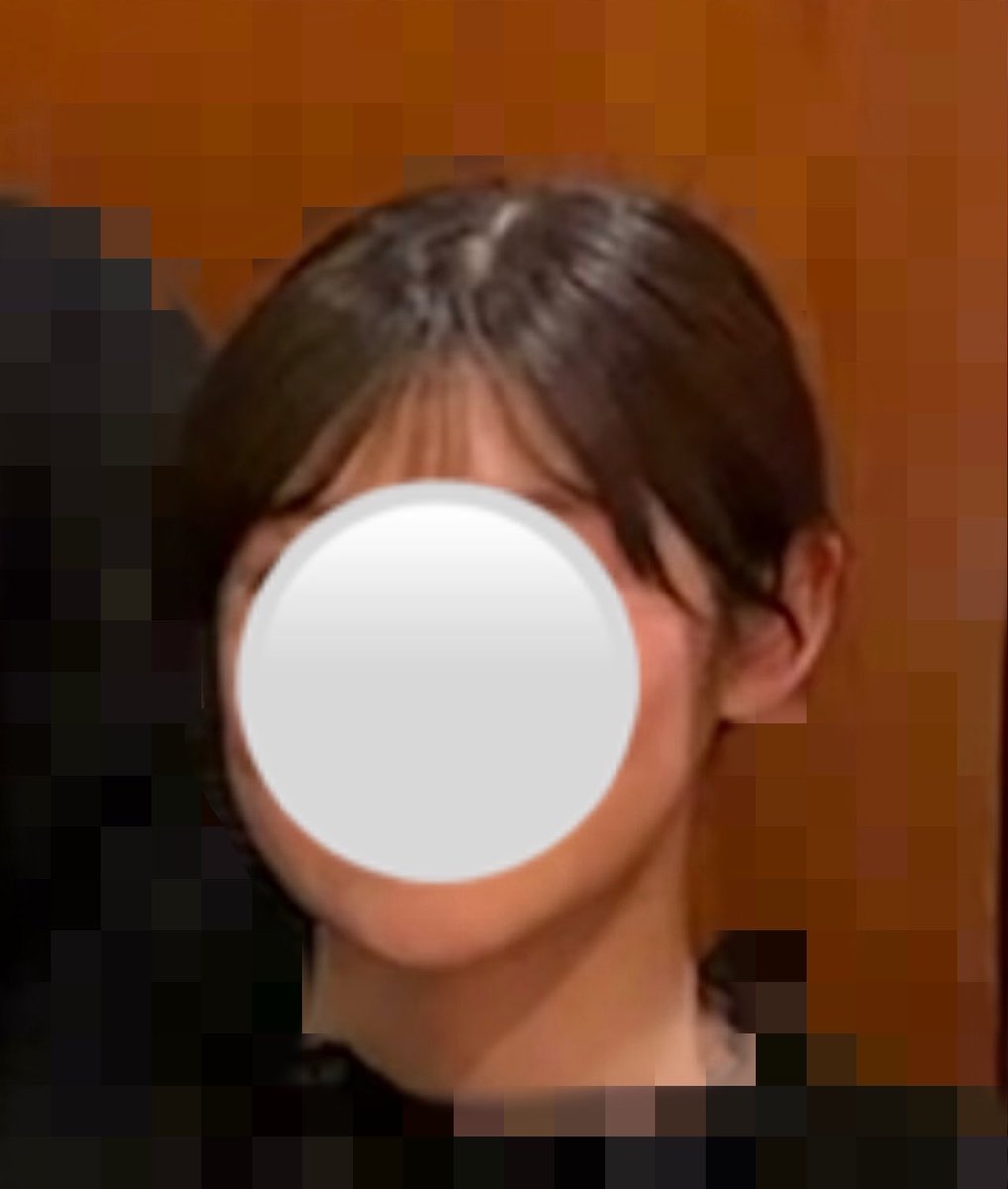 insenhanguku's tweet photo. 🇰🇷輪郭3点⑱

術後6ヶ月目です。

同じく変化はありません。
けど、やってみて本当に良かったです。

改めてオペラの先生、看護師さん、カウンセラーさん、皆さんに感謝しています。

今度渡韓する時は経過を見ていただけると嬉しいです。

個人的に半年後の生存を確認できている輪郭3点の⬇️ https://t.co/Uvi4SldeDj
