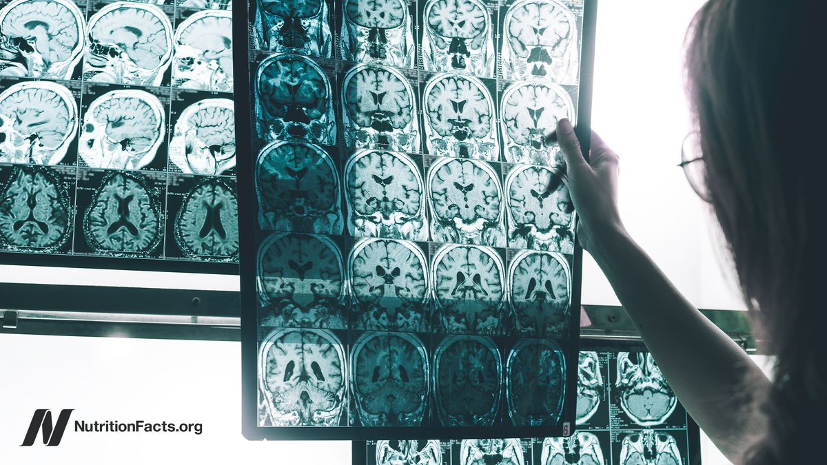 nutrition_facts's tweet photo. How can we avoid the breakdown products of pesticides that may increase the risk of Alzheimer’s disease as much as if you carried APOE e4, the so-called Alzheimer’s gene? https://t.co/uMO7dhHxWI https://t.co/FuNO6BfN17