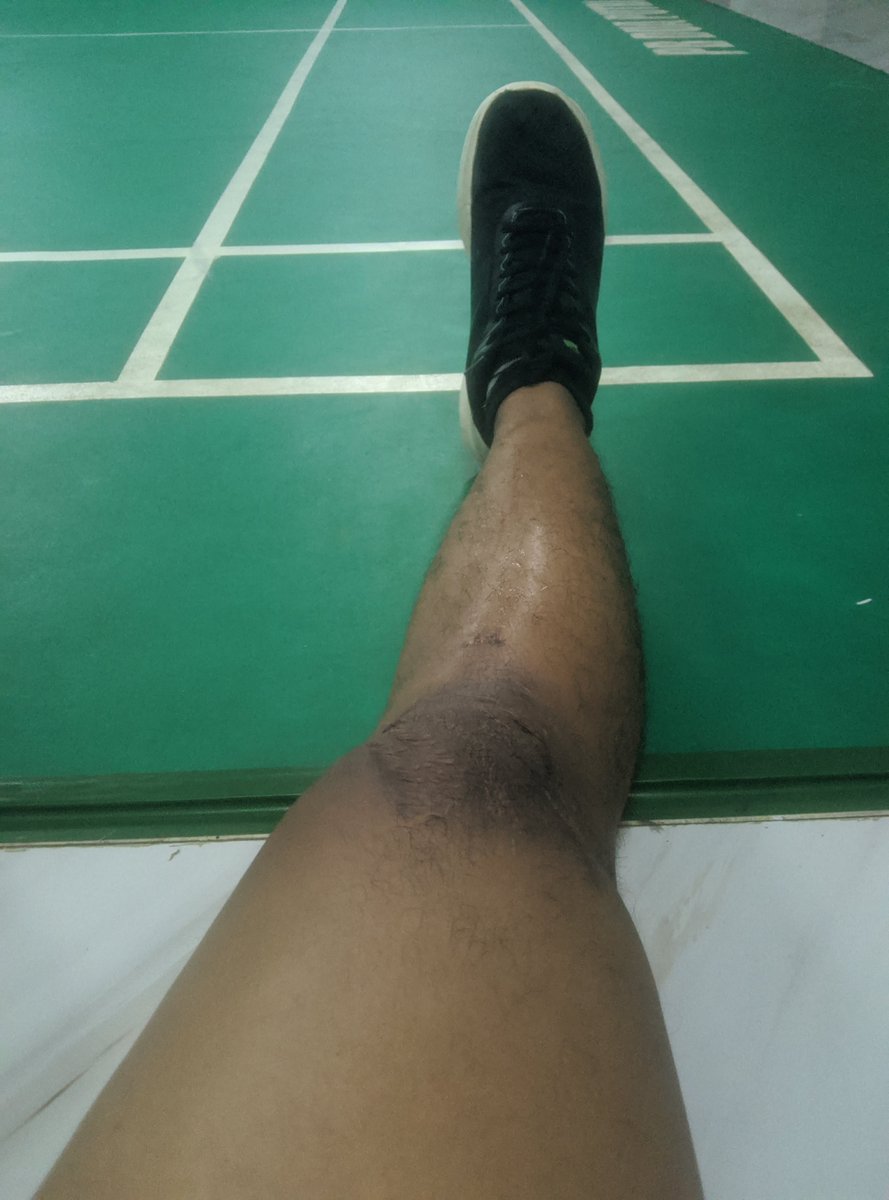 masssdhan's tweet photo. setelah 1 ½ tahun tidak ber olahraga berat, akhirnya jahitan nya sudah bener bener kuat ga koyak lagi
sebelum insiden BB stabil di 70an
BB sekarang di 85an https://t.co/QIQnkI2gc6