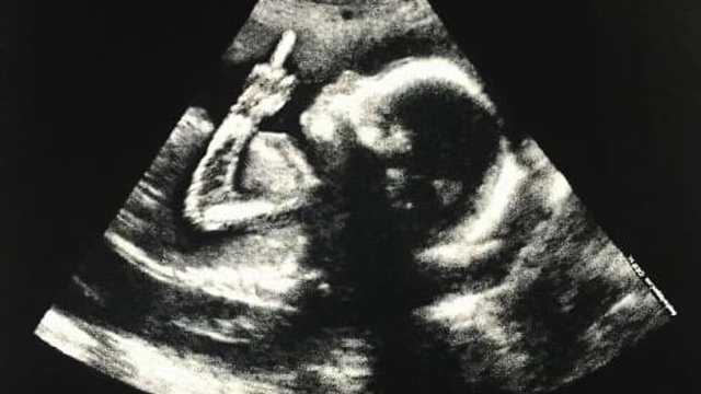 lasourcegg's tweet photo. 🇫🇷 apEx a annoncé sur son Instagram qu’il allait bientôt devenir papa d’un petit garçon. La naissance est prévue pour la fin de l’année 2026 👼

Félicitations aux futurs parents 🫶 https://t.co/o6HZI0me0h