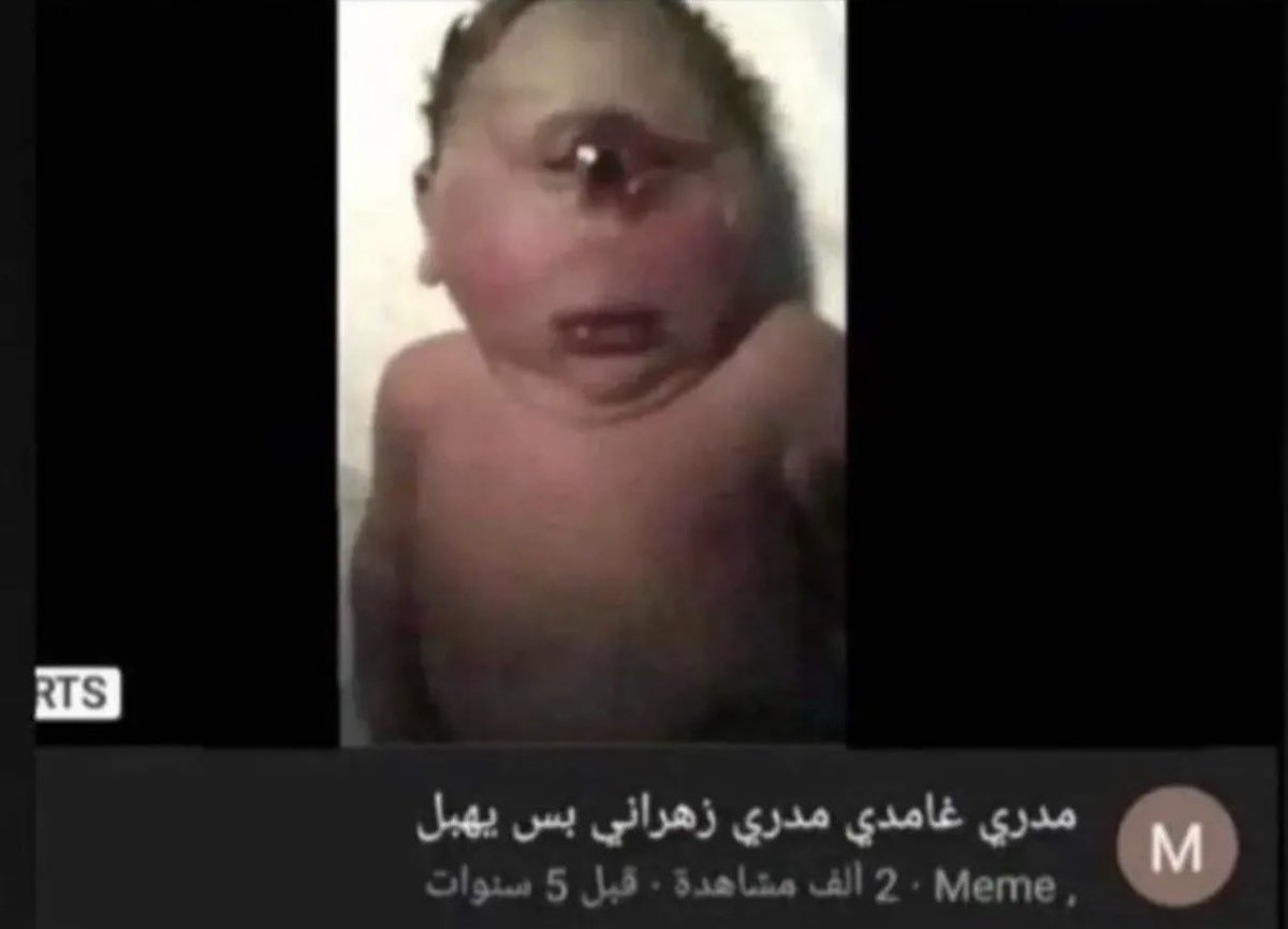 moder__x's tweet photo. المخلوق الي بيطلع لك بعد ما تتزوج وحده كلها عمليات تجميل https://t.co/NjsYjF3Tde