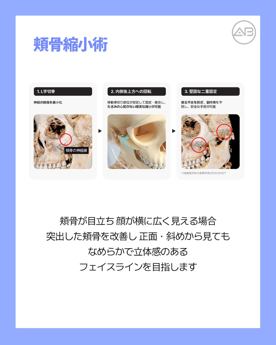 ABPRS_JP's tweet photo. https://t.co/RAirOJ031B