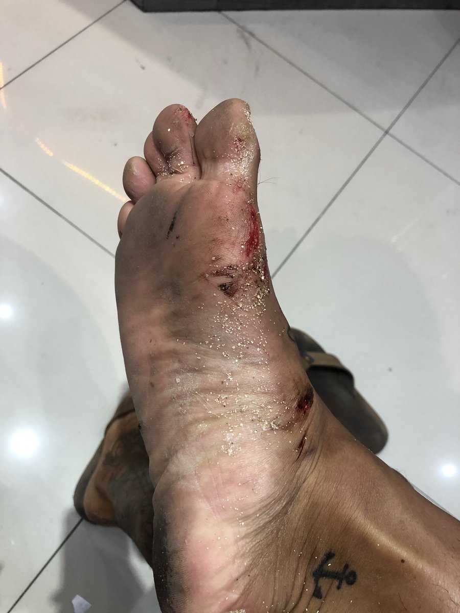 kenmmm1's tweet photo. ちょーいい波
20秒ほど海に引きずり込まれ足のお肉が千切れたが最高 https://t.co/6CstPzZRis
