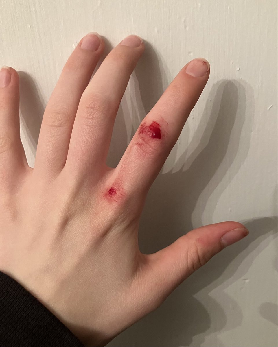 hateto_admit's tweet photo. SFX MAKEUP #shrtwt #988twt #shedrtwt 

i LOVE LOVE LOVE doing SFX makeup TOTALLY FAKE NOT REAL on my hands !!!!! https://t.co/PG0IyhQj2l