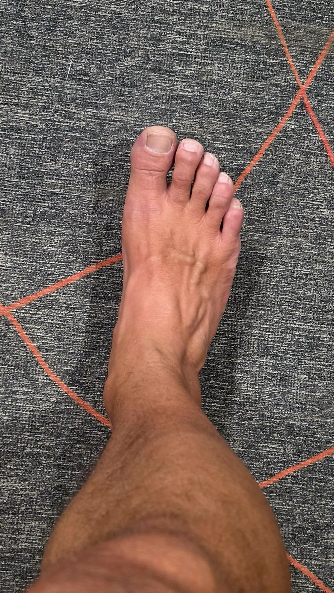 footguy1969's tweet photo. Just need some help with a little grooming.. any takers? https://t.co/qLynwBmNec