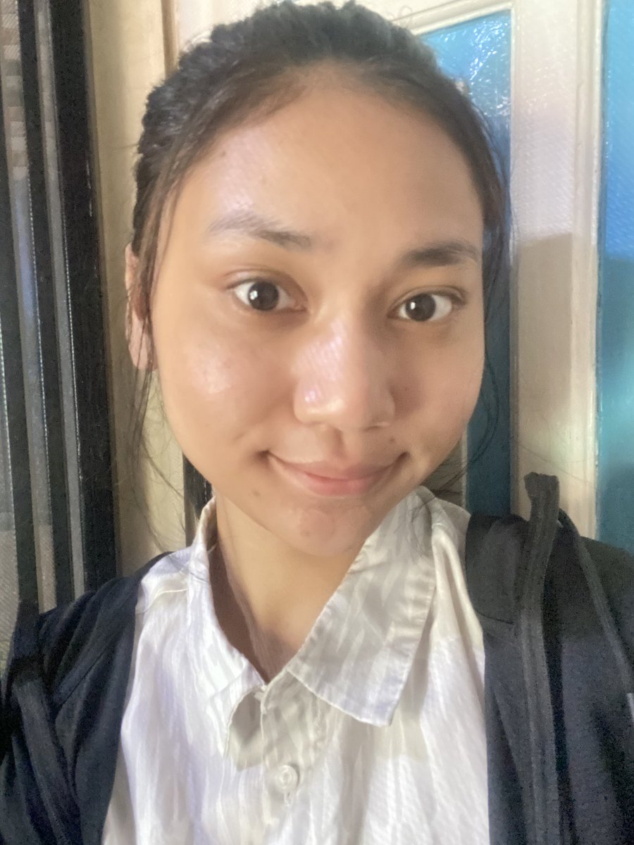 eufrasiarts's tweet photo. mau ga percaya tapi kalimat “your body will automatically reject someone who’s not meant for you” tuh kayaknya bener deh…

karena selain siklus mens jadi lancar setelah aku sama cowo aku, ternyata aku sekarang jadi jarang jerawatan dan ngerasa muka jadi lebih bersih juga 🥺 

kiri sebelum (JELEK BGT AWOAKWO), kanan sesudah!!! 😍✨ 

padahal dulu tiap mens tuh pasti muncul jerawat gede-gede 3-5 biji, kalo sekarang beneran jadi JARANGG BANGETT 😭

btw kayaknya ini berlaku juga deh sama lingkungan kerja dsb… 🥺
