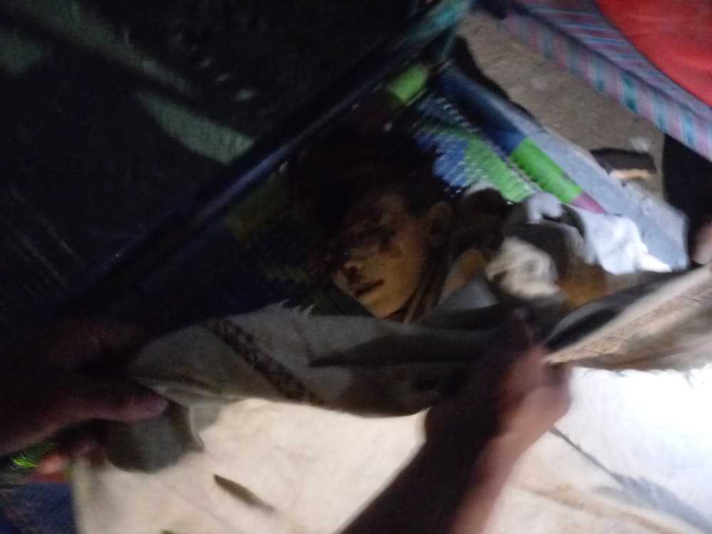asiafront0's tweet photo. 🚨 Breaking

Pakistani airstrikes have caused heavy civilian casualties among Afghan civilians in the provinces of Kunar, Khost, and Paktika. https://t.co/KffkCmPJdO