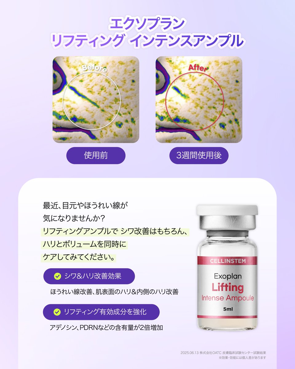 cellinstem's tweet photo. 最近話題のエクソソーム💎
実は肌悩みに合わせて選べるって知ってた？👀

🔸 赤み・乾燥
♦️ ハリ・弾力
🔹 透明感・トーン

今の肌にぴったりの1本を見つけてみて✨

#韓国コスメ #韓国スキンケア https://t.co/katqdb9Ioo