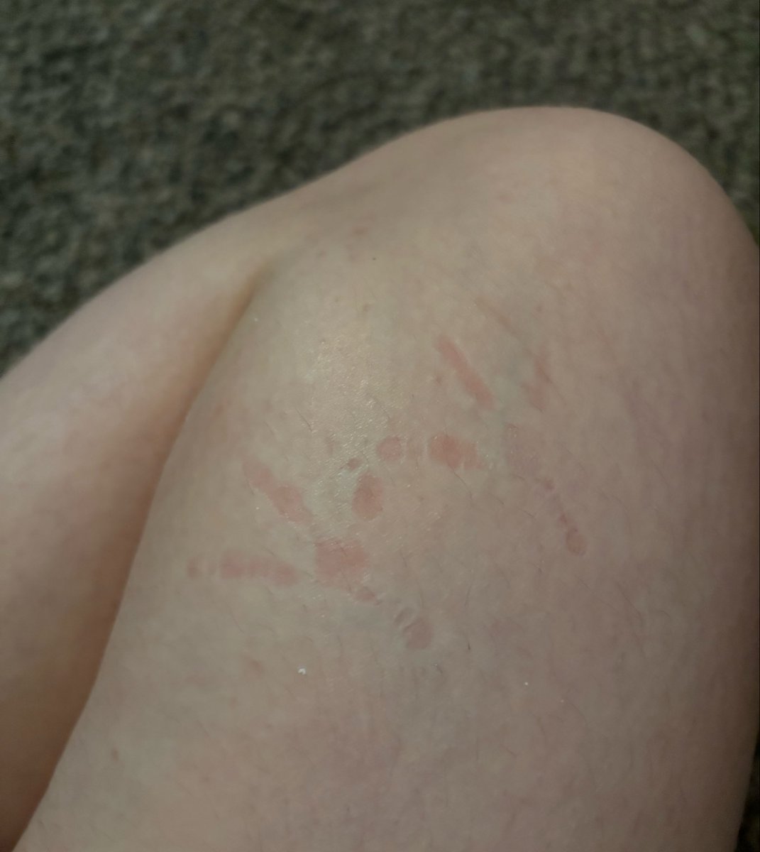 notSIug's tweet photo. he sat on my leg so long he left footyprints 😭😭😭😭😭😭😭 https://t.co/cUp5EqzZqX