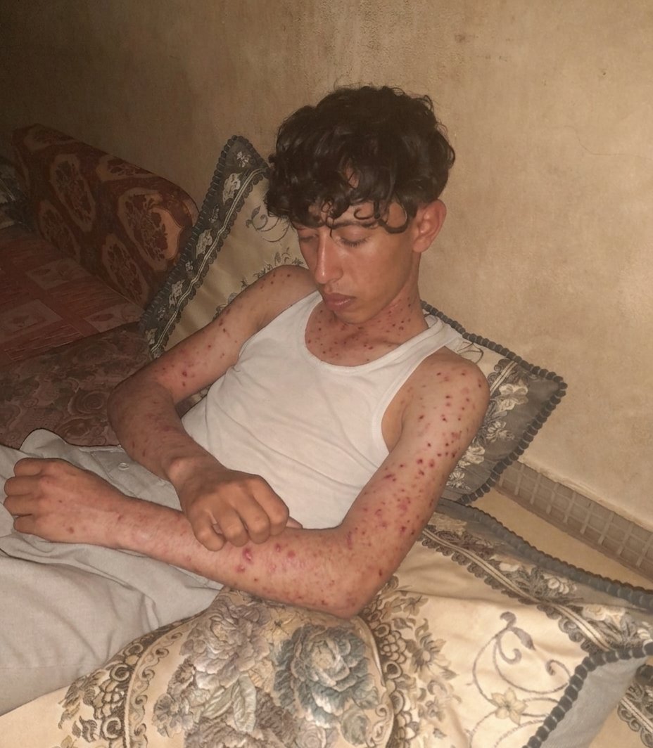 jamil_GZ's tweet photo. 🚨💔This illness has turned my life upside down. Every day is a struggle with pain and the cost of treatment. Any support, no matter how small, would mean so much to me. 🙏
https://t.co/8M5aaLjfeu https://t.co/M7dH9FxYpi